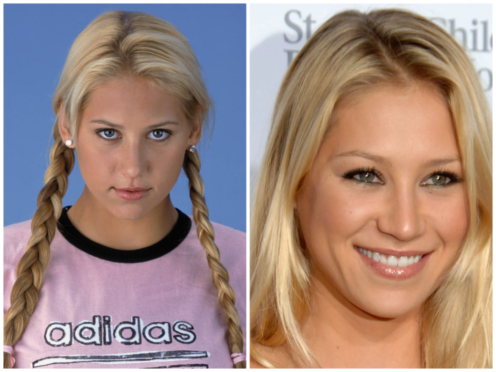 La Edad de Anna Kournikova: La historia de una estrella del tenis que sigue despertando interés La Edad de Anna Kournikova